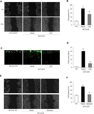 Coptidis Rhizoma Suppresses Metastatic Behavior by Inhibiting TGF-β-Mediated Epithelial-Mesenchymal Transition in 5-FU-Resistant HCT116 Cells